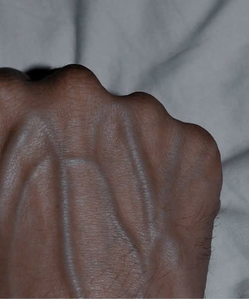 Why Are My Veins So Visible? A Complete Guide to Understanding Prominent Hand Veins