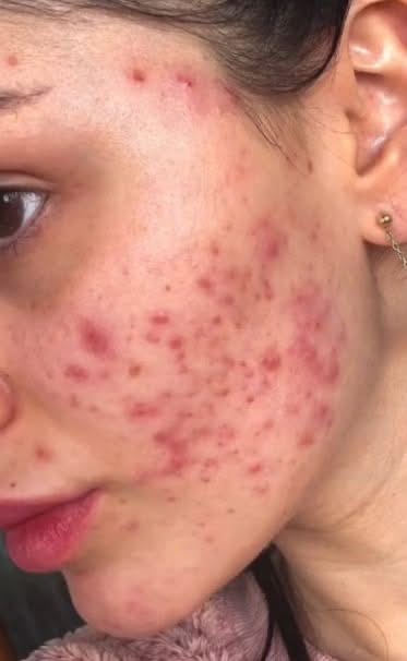 These are the consequences of sleeping with the…See more