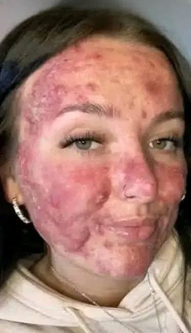 Her Body Was Itchy — He Thought It Was Just an Allergy, But Then This Happened