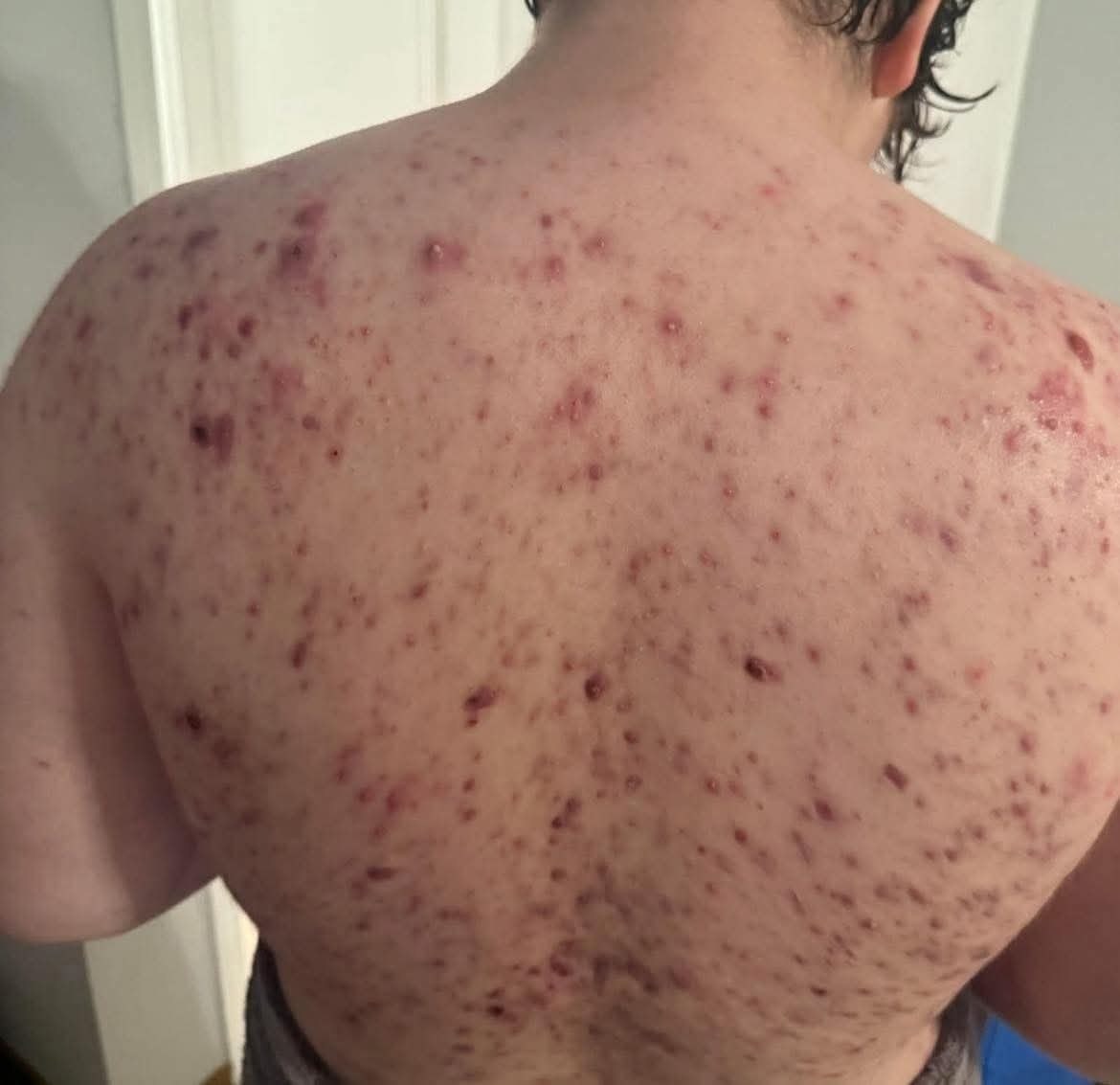 The Far-Reaching Consequences of Choosing the Wrong Person for Intimacy