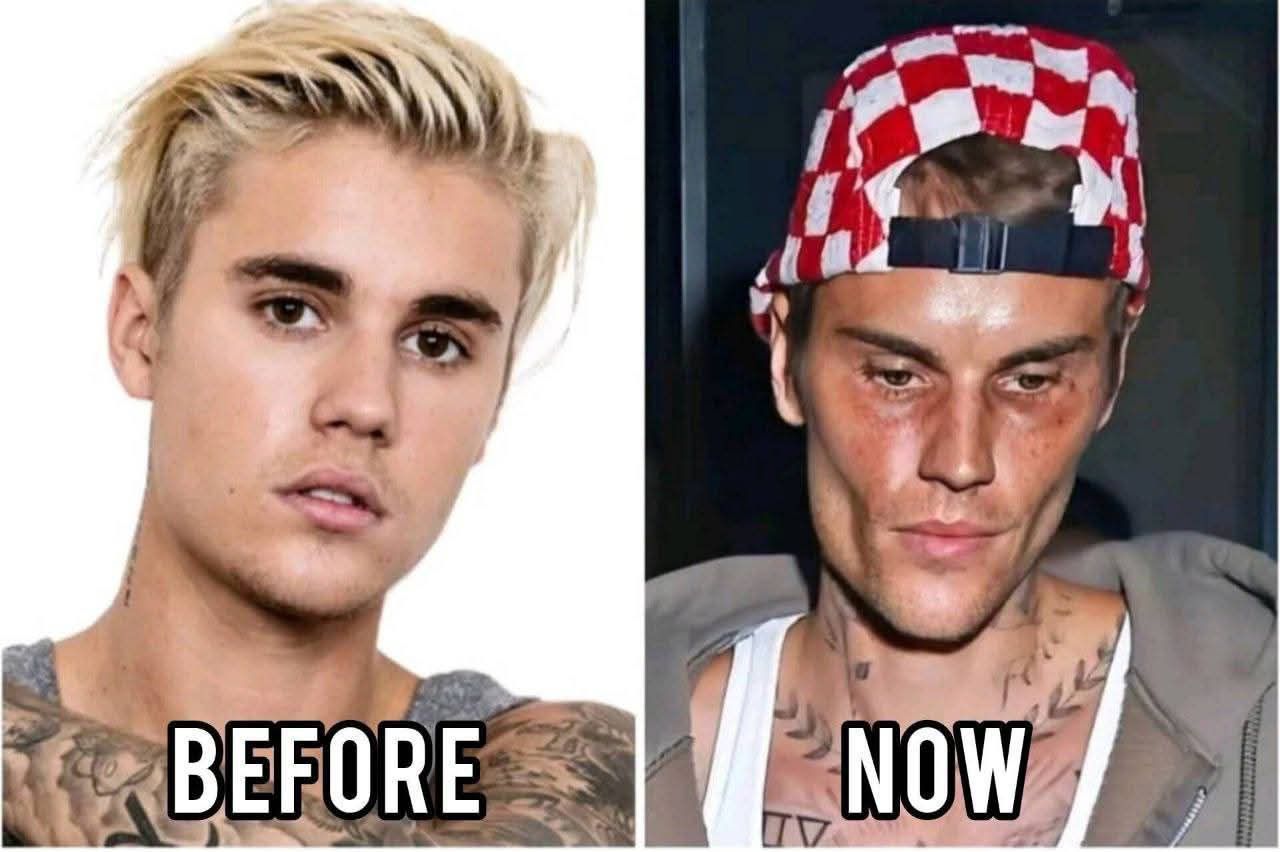 Justin Bieber admits that he tested positive for…See more