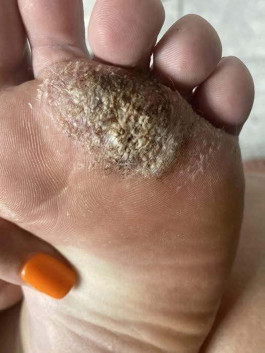 BE VERY CAREFUL . If you get this, you are infected with ….