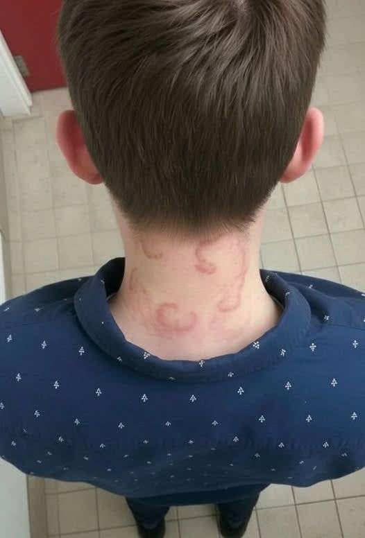 “My 8-Year-Old Has Been Dealing With This for Two Months and It’s Only Getting Worse” — What Parents Should Know When a Child Develops Persistent Ring-Like Rashes on the Neck, Why Early Evaluation Matters, and How to Think Calmly and Clearly About Possible Causes